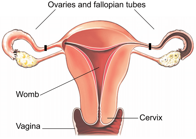 female sterilization diagram