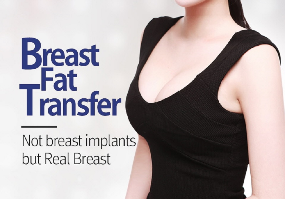 breast fat transfer