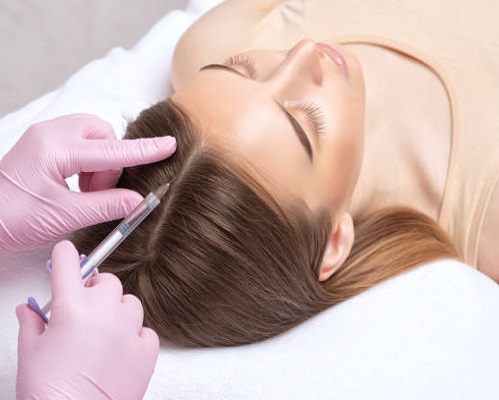 Unveiling the Benefits of PRP Hair Treatment in Islamabad